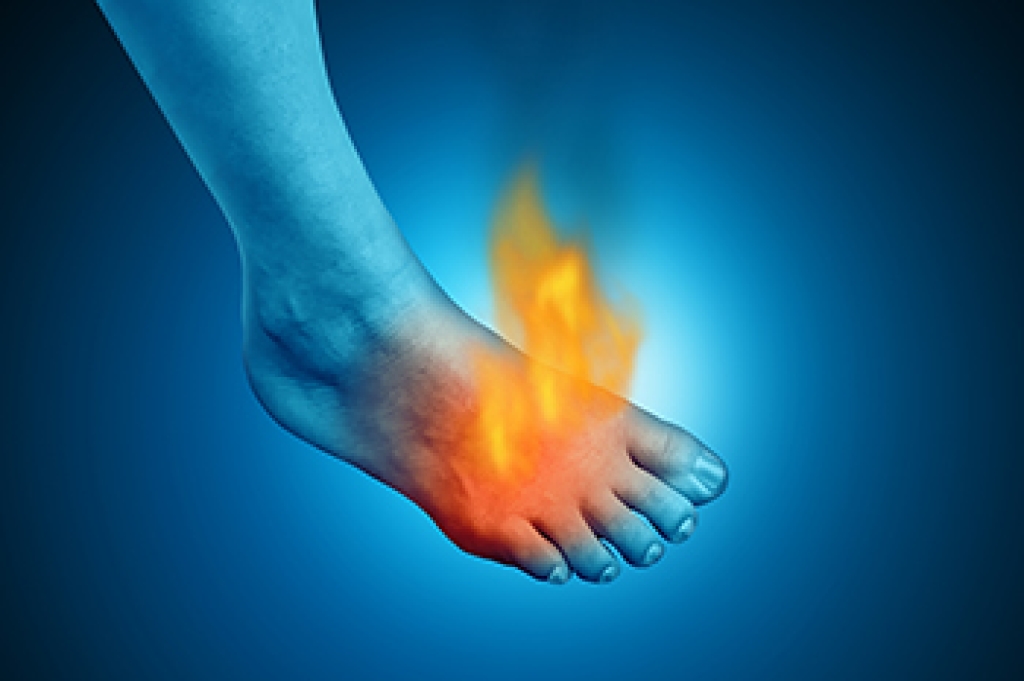 Erythromelalgia and Painful Burning Feet
