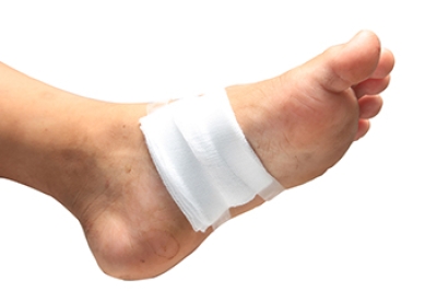 How Skin Reactions Can Escalate to a Foot Ulcer