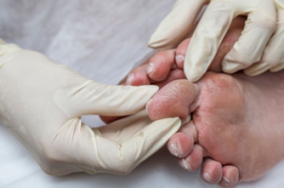Importance of Diabetic Foot Exams